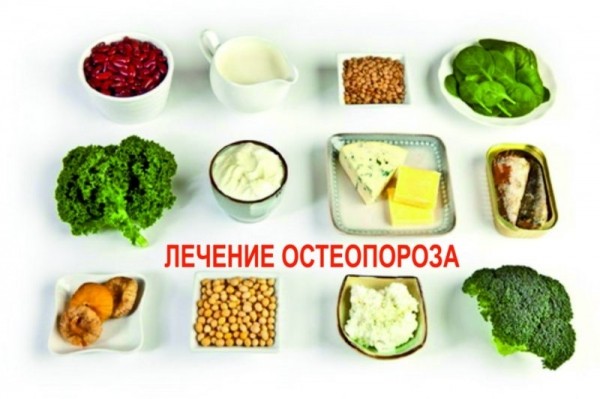 Что такое остеопороз, симптомы и причины болезни костей Что такое остеопороз, симптомы и причины болезни костей
