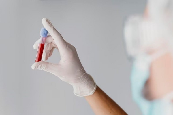 Есть &laquo;железные&raquo; продукты с источниками витамина С: врач рассказал, как повысить свой гемоглобин
