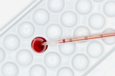 Sotagliflozin повышал уровень гемоглобина у пациентов с сахарным диабетом 2-го типа